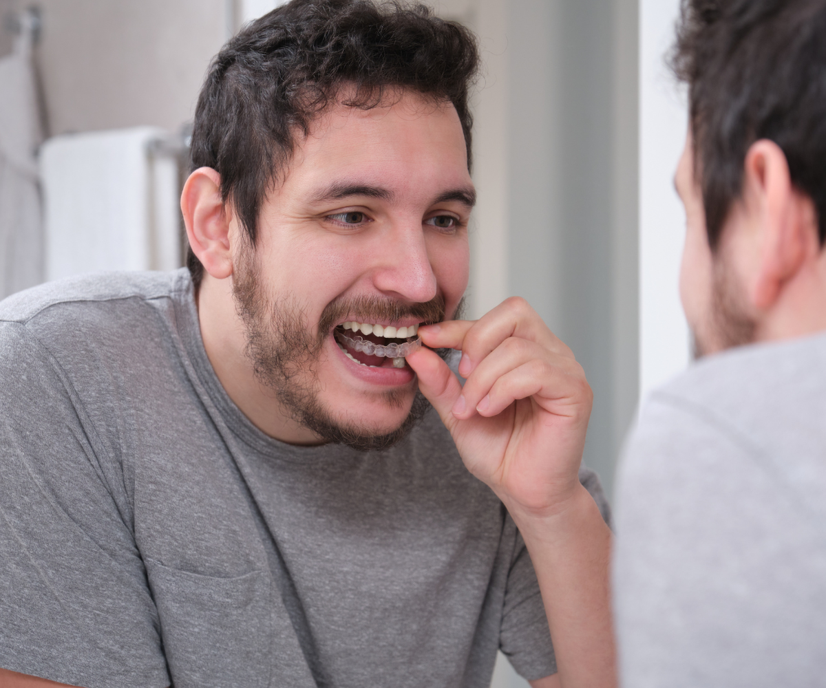 man inserting invisalign tray to straighten teeth discreetly