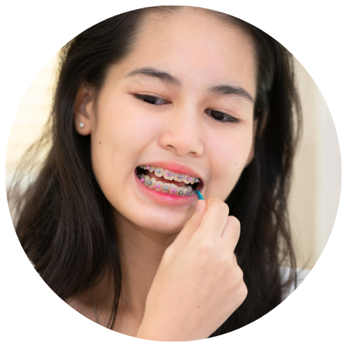 girl cleaning her metal braces with an orthodontic flosser