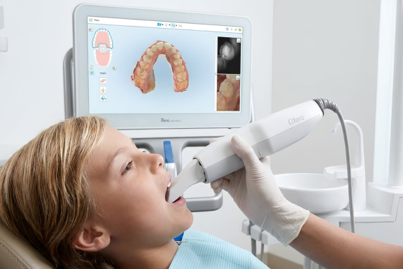 child getting a 3D scan of his teeth at his free orthodontic consultation